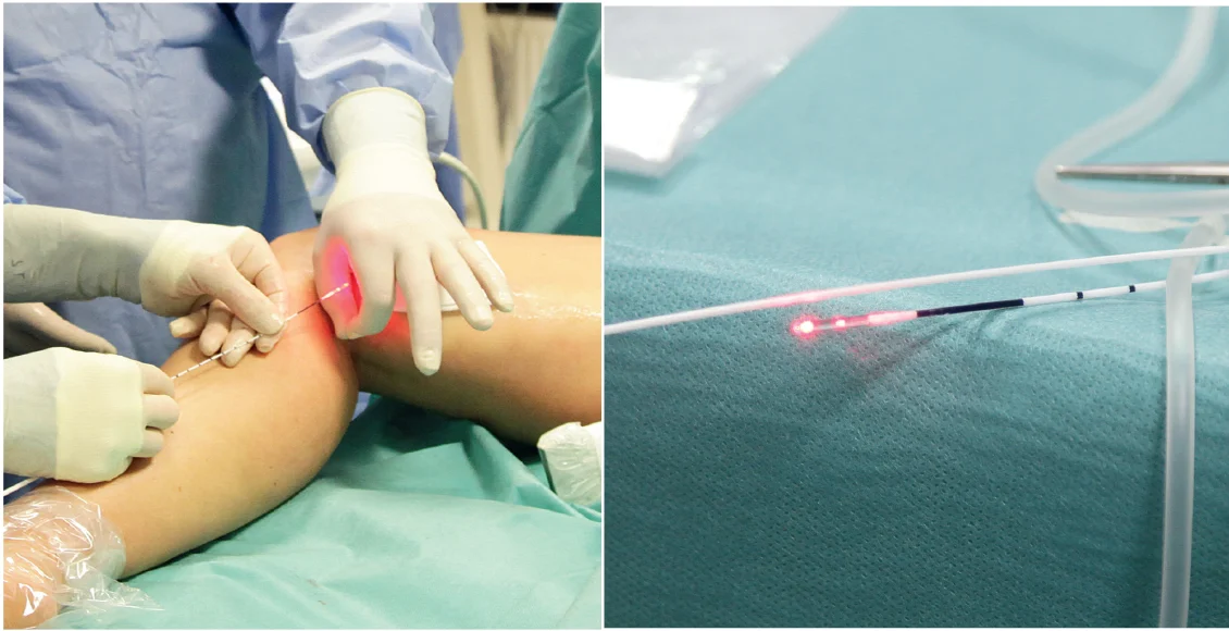 AEEDC Dental Expo 2018